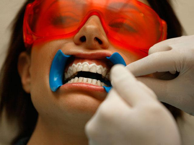 Dantų balinimo procedūra: apžvalgos ir rekomendacijos
