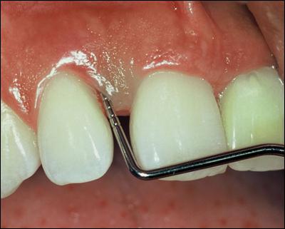  periodonto ligos istorija