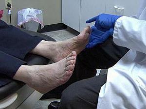 Augantys nagai ant kojų: priežastys ir gydymo metodai